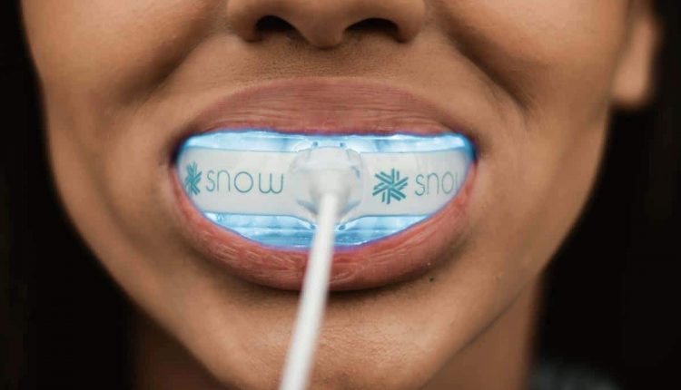 Snow – A Million Dollar Smile In Under 5 Minutes A Day